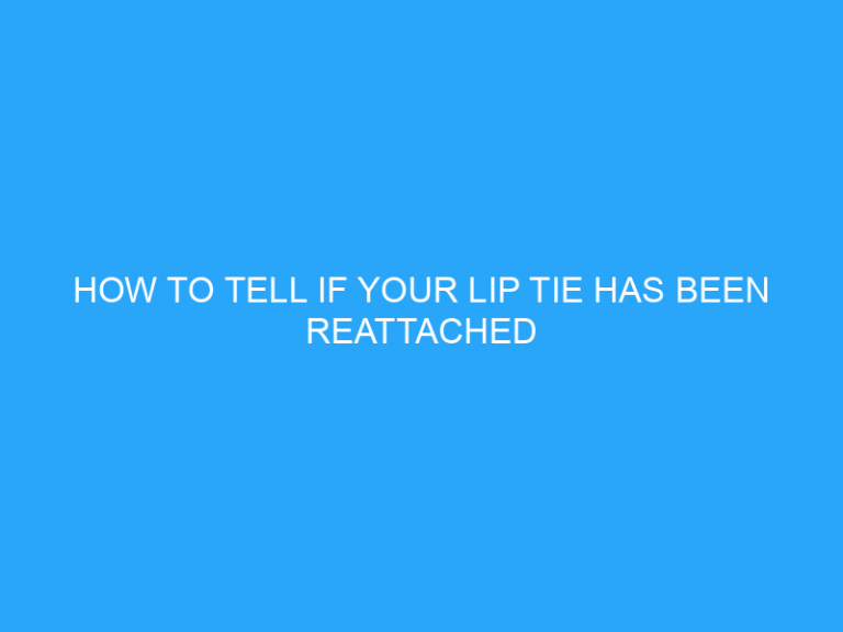 How To Tell If Your Lip Tie Has Been Reattached