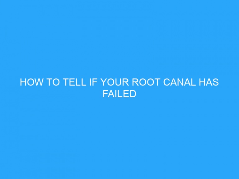 How To Tell If Your Root Canal Has Failed