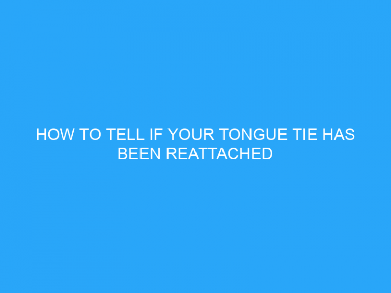 How To Tell If Your Tongue Tie Has Been Reattached