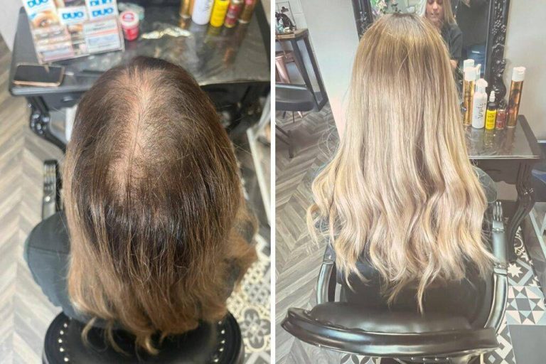 2023’S Best Hair Extensions For Thinning Crown: Find The Perfect Fit!