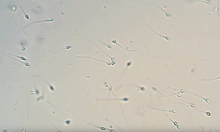 2023 Guide To The Best Microscope For Viewing Sperm: Discover What Microscope Technology Can Do For You!