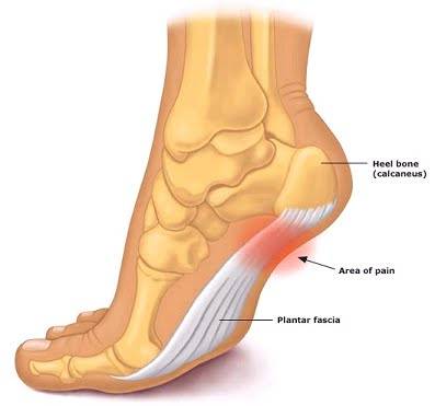 2023’S Best Sandals For Morton’S Neuroma & Plantar Fasciitis Relief: Stop The Pain For Good!