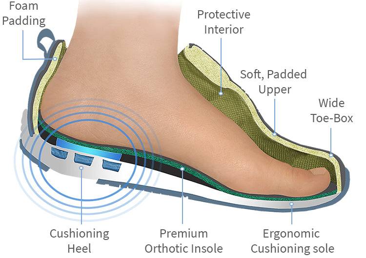 2023: The Year Of Comfort – Discover The Best Shoes For Swelling Feet!