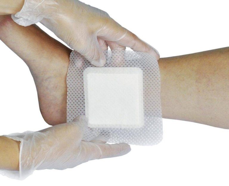 2023’S Top-Rated Wound Dressings For Diabetic Foot Ulcers – How To Find The Right Care!