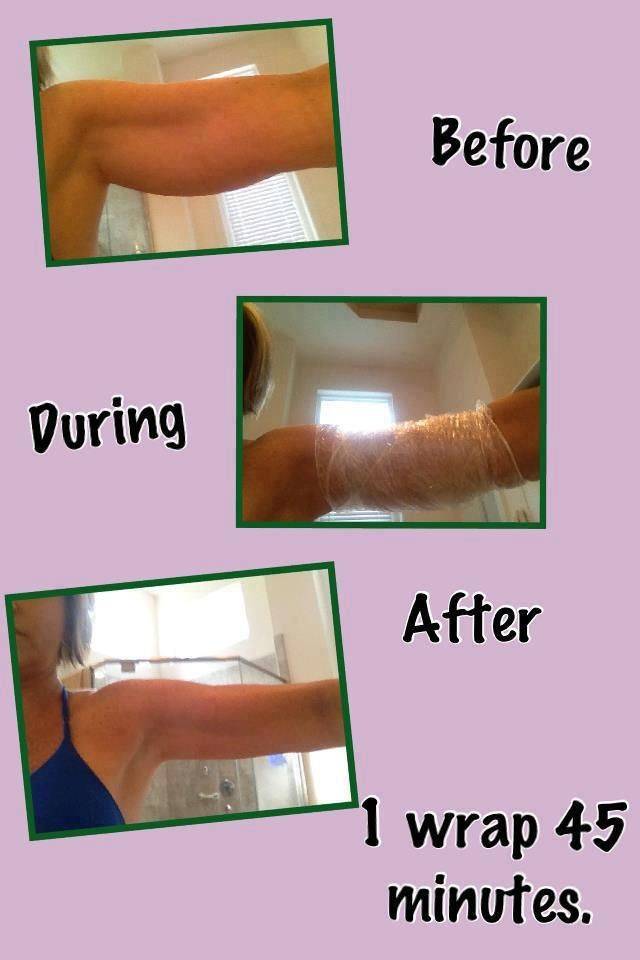 Revamp Your Weight Loss Journey With Top Arm Wraps In 2023: Boost Fat Burning & Achieve Toned Arms!