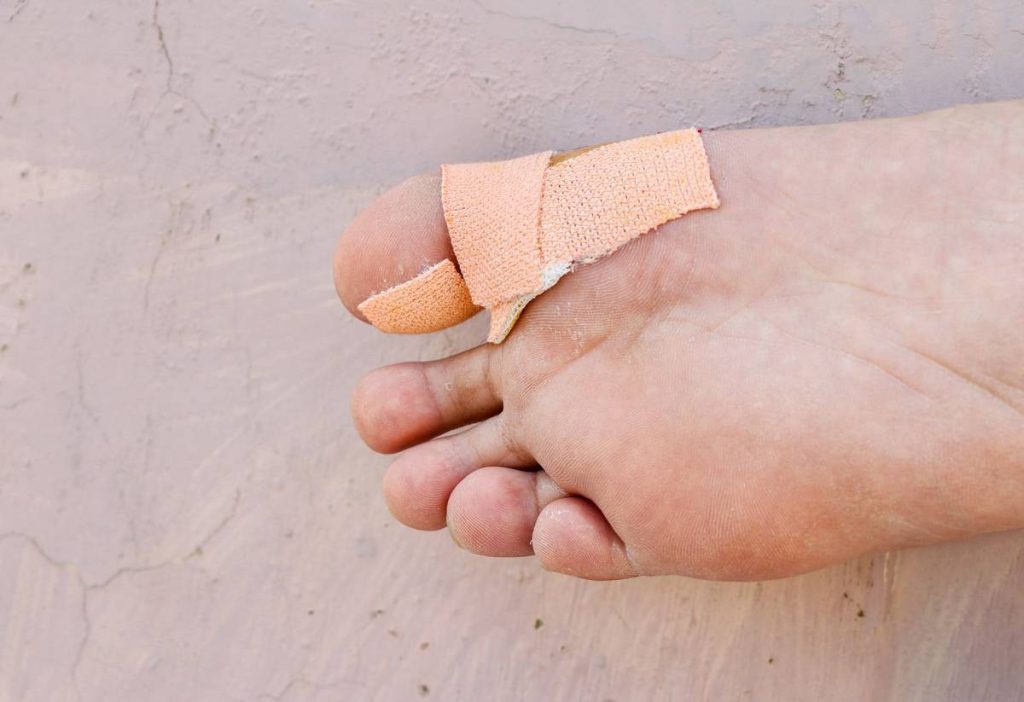 the-ultimate-guide-to-the-top-big-toe-band-aid-of-2023-find-the