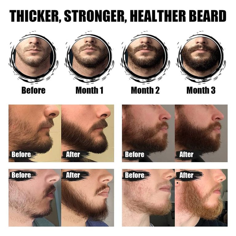 2023’S Best Beard Growth Oil For Patchy Beards: Get A Fuller, Thicker Beard Now!