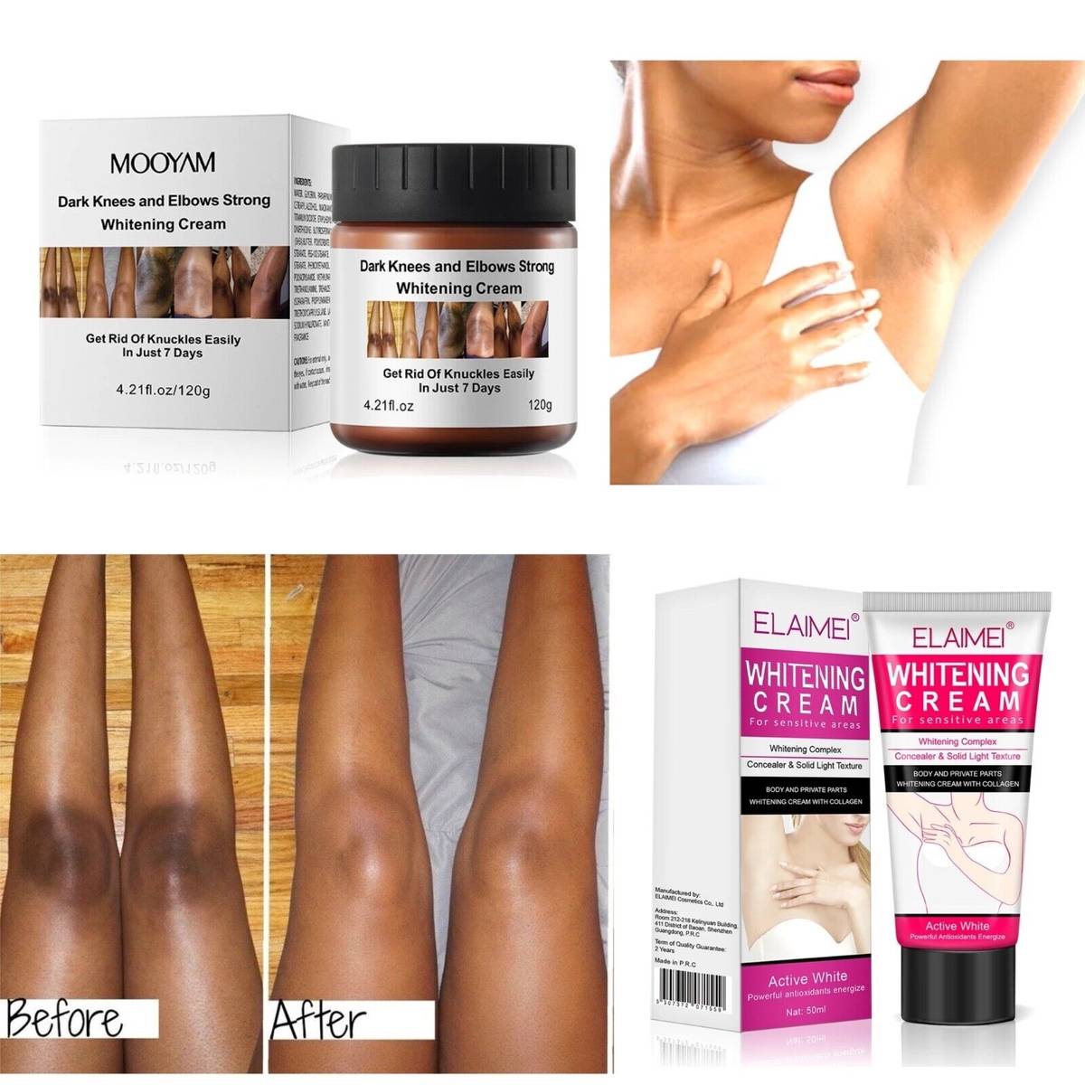 top-10-creams-for-dark-elbows-to-achieve-flawless-skin-in-2023