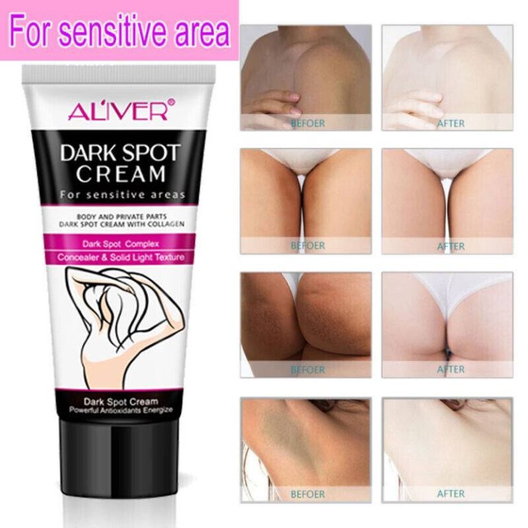 The Top Skin Lightening Creams For Private Areas In 2023 – Achieve Flawless Skin Safely!