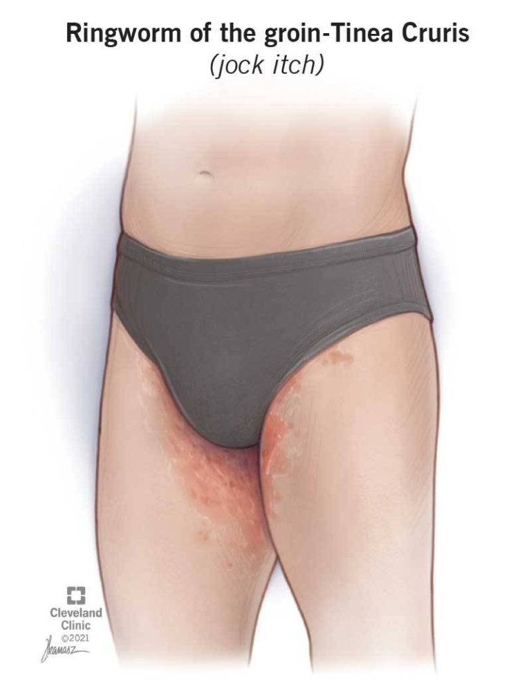 Stay Itch-Free: The Top Jock Itch Prevention Underwear For 2023!