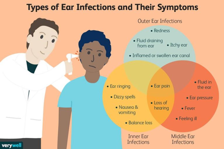 Your Ultimate Guide To The Top Adult Ear Infection Antibiotics In 2023: Find Relief Now!