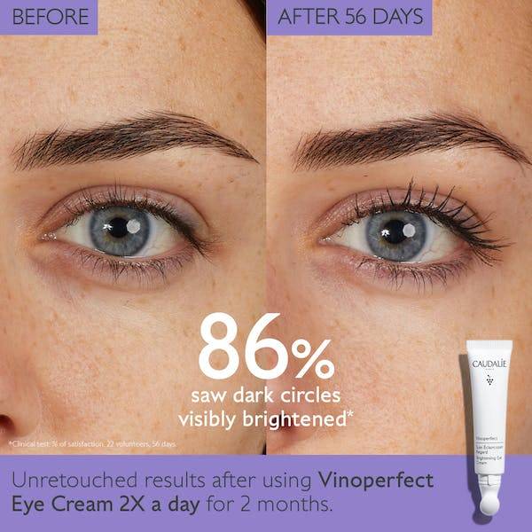 2023’S Top Under Eye Cream For Bags: Bid Farewell To Puffy Eyes!