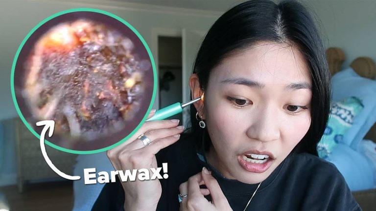 Clearing The Way: 2023’S Top Ear Wax Removal With Camera Revealed!